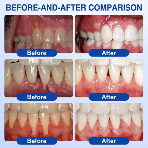 🏆GumRevive Periodontal Care Gel