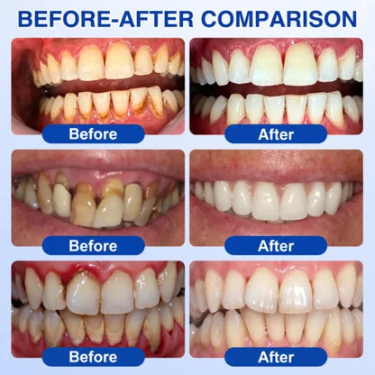 🏆GumRevive Periodontal Care Gel