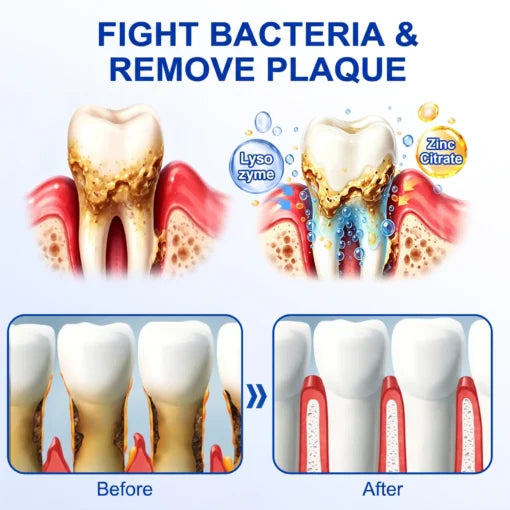🏆GumRevive Periodontal Care Gel