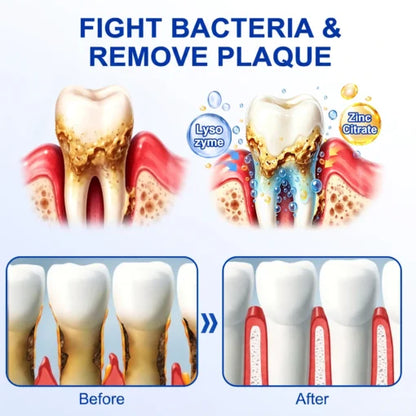 🏆GumRevive Periodontal Care Gel