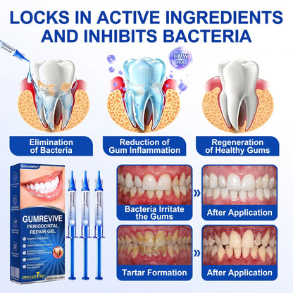 🏆GumRevive Periodontal Care Gel